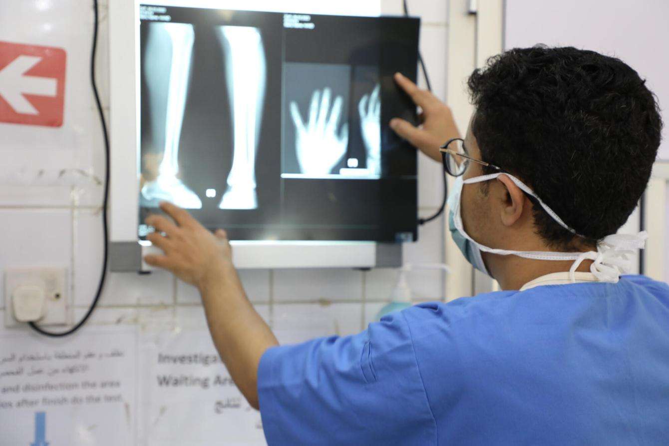 An MSF doctor in blue scrubs looks at a patient's X-ray in a hospital in Yemen