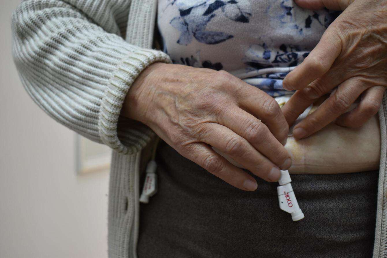 An MSF patient holds the a part of her catheter near her body at a medical facility in Belgorod.