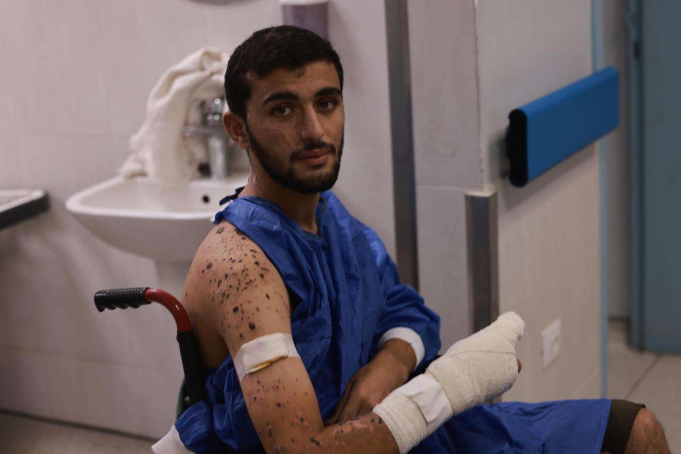 A young Palestinian man shows his wounded arm at Nasser Hospital in Gaza.